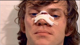 Malcolm McDowell in una sequenza di ARANCIA MECCANICA