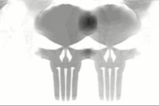 The Punisher - Teaser