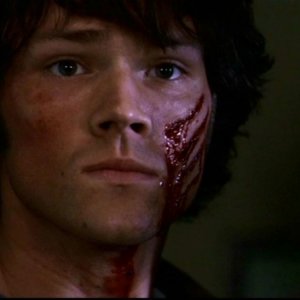 Jared Padalecki, nel ruolo di Sam, ferito dopo lo scontro con un demone nell'episodio 'Ombre' di Supernatural (stagione 1)