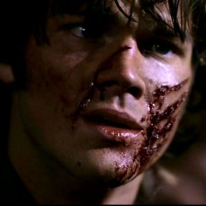 Jared Padalecki, nel ruolo di Sam, ferito dopo lo scontro con un demone nell'episodio 'Ombre' di Supernatural