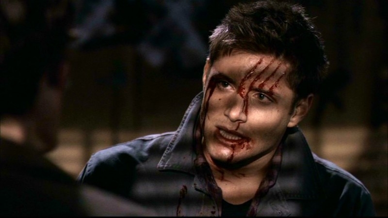 Jensen Ackles Nel Ruolo Di Dean Appena Sfuggito All Attacco Di Un Daeva Nell Episodio Ombre Di Supernatural 57389