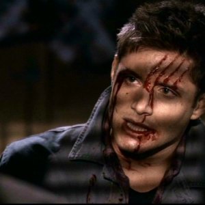 Jensen Ackles nel ruolo di Dean, appena sfuggito all'attacco di un Daeva nell'episodio 'Ombre' di Supernatural