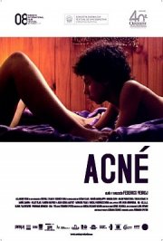 La locandina di Acné