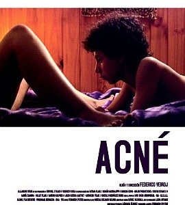 La locandina di Acné