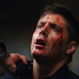 Un sofferente Jensen Ackles nell'episodio On the Head of a Pin di Supernatural
