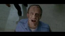 2x03 - Fracture - Fringe - Promo