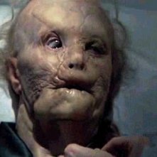 Gary Oldman orribilmente sfigurato in Hannibal