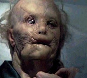 Gary Oldman orribilmente sfigurato in Hannibal