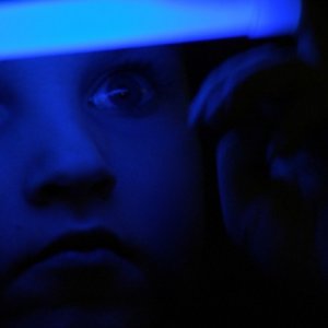 The dark side of the sun, uno dei bambini affetti da Xeroderma Pigmentosum protagonisti del documentario