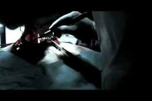 Trailer Italiano - Bloodline