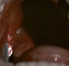 Una sanguinosa scena di Opera di Dario Argento