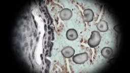 Spot - The Gerber Syndrome - Il contagio