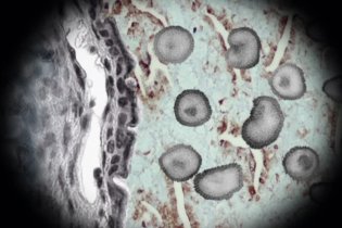 Spot - The Gerber Syndrome - Il contagio