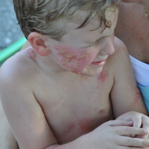 The Bay: una piccola vittima del contagio in una scena dell'horror di Barry Levinson