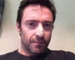 Hugh Jackman operato per un tumore