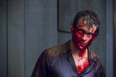 Hannibal: Hugh Dancy insaguinato in una scena della puntata intitolata Primavera