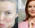 Marcia Cross, il dramma di Bree: 'Ho avuto il cancro, ma ora sto meglio'