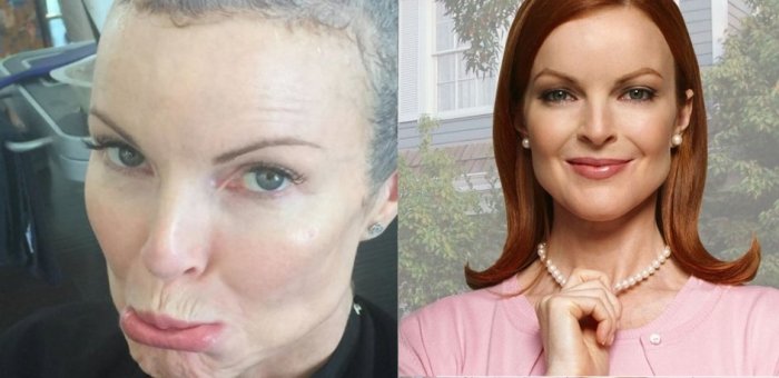 Marcia Cross, il dramma di Bree: "Ho avuto il cancro, ma ora sto meglio"