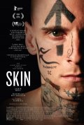 Locandina di Skin