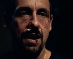 Uncut Gems: Adam Sandler col volto tumefatto nel teaser del thriller