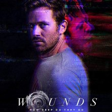 Locandina di Wounds