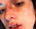 Bella Thorne, il trucco di Halloween è shock: 'Offende le vittime di violenza'