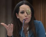 Gessica Notaro mostra l'occhio dopo l'operazione: 'Hanno dovuto tagliarlo'