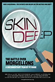 Locandina di Skin Deep: The Battle Over Morgellons