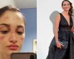 Venezia 77: Alessia Bonari, l'infermiera simbolo della lotta al Covid, sul tappeto rosso
