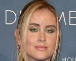 Valentina Ferragni, il brufolo: 'Era un tumore maligno, non una cisti'