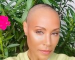 Jada Pinkett Smith e la malattia: 'L'alopecia ed io saremo amici... punto!'