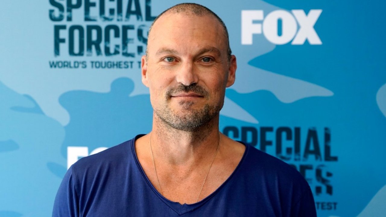 Brian Austin Green: 'Per quattro anni ho avuto i sintomi dell'ictus a causa di una dieta sbagliata'