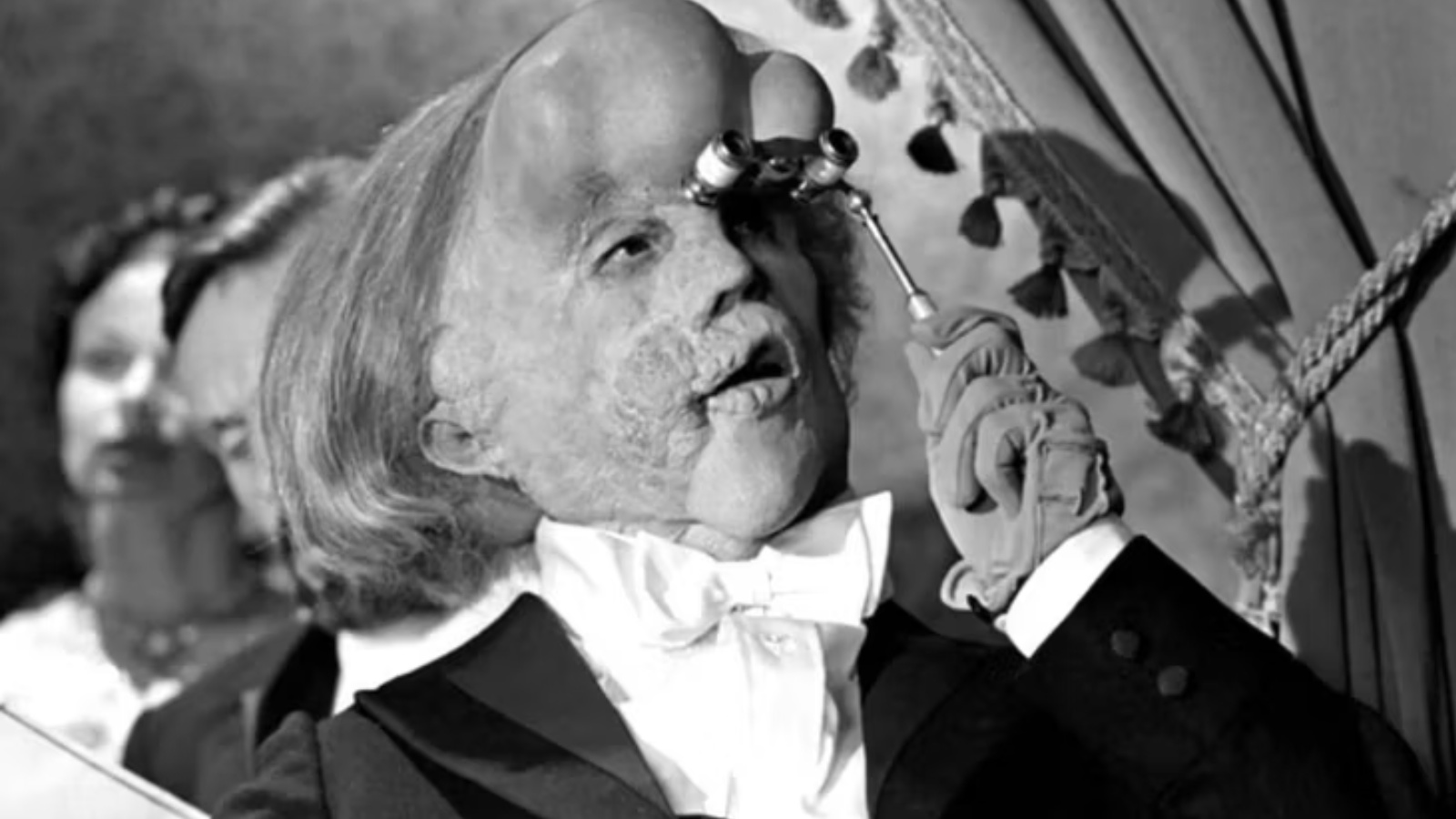 John Hurt nei panni di The Elephant Man.