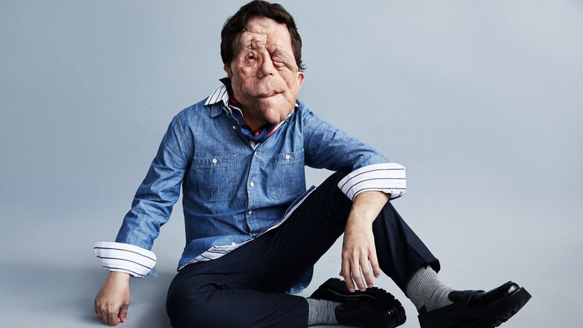 Adam Pearson, star di A Different Man, sarà il protagonista di The Elephant Man Adam Pearson, star di A Different Man, sarà il protagonista di The Elephant Man