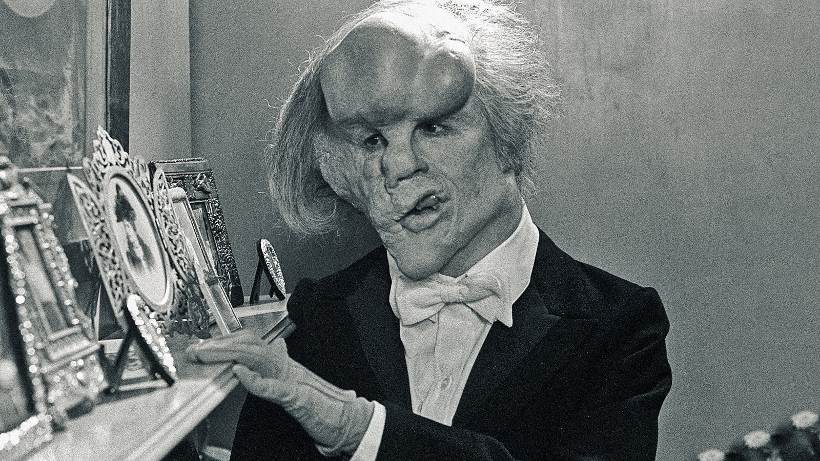 John Hurt nei panni di The Elephant Man.