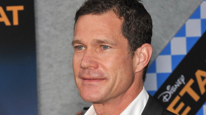 Dylan Walsh, la star di Nip/Tuck ha avuto un ictus prima dell’incidente d’auto