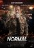 Normal